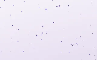 Thistledown Toss — light purple and white confetti background