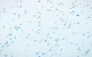 Arctic Frost Cherries Dense II — light blue and white cute background, variation II