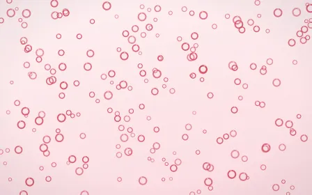 Cherry Soda Rings Dense — light red and white playful background