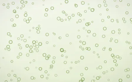 Matcha Latte Rings Dense — light green and white playful background
